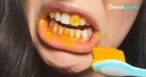 The Science Behind Turmeric Teeth Whitening