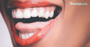 close-up of a woman's mouth and teeth