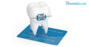 oral braces cost